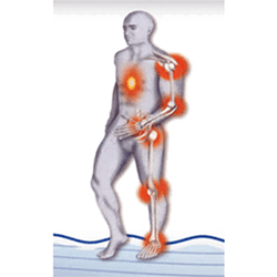 Antiinflamatoare